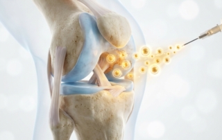 Detailed knee joint illustration with glowing stem cells for stem cell therapy for joint pain treatment