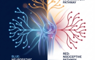 Stylized illustration of a knee joint with three color-coded pain mechanism zones for treatment of knee joint pain