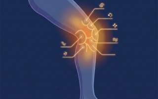 Stylized illustration highlighting pain on outer side of knee with anatomical zone mapping in warm amber tones