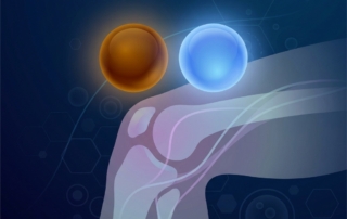 Conceptual illustration representing bone marrow concentrate therapy orthopedics and PRP biologic treatment options