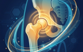 Stylized illustration of a hip joint with regenerative energy, representing trochanteric bursitis injection treatment options
